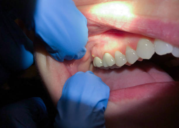 Best Emergency Root Canal Treatment in North Druid Hills, GA